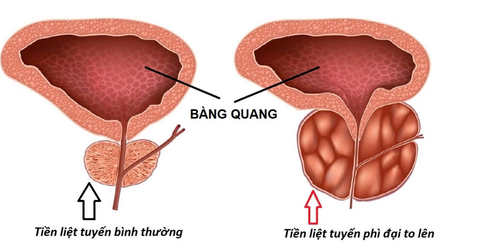 Media.NewsItem.ImageAlternateTextFormat