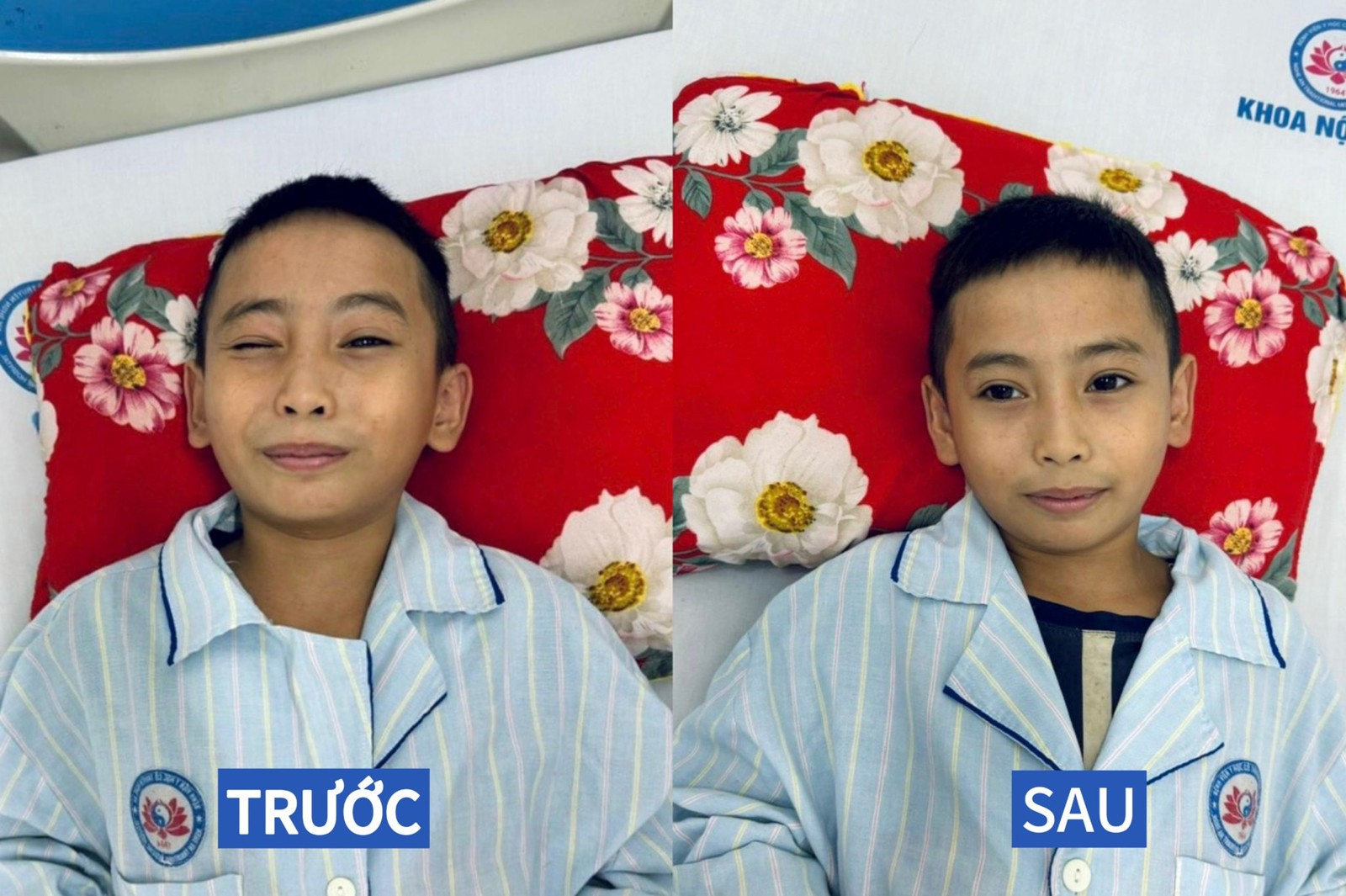 Media.NewsItem.ImageAlternateTextFormat